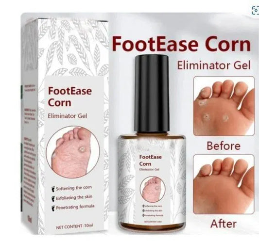 Feet Corn Removal Serum 30ml ( Pack Of 1 ) - Advanced Nourishing Premium Skin & Beauty Care