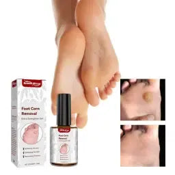 Feet Corn Removal Serum Ml