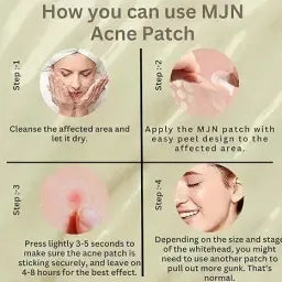 Acne Clearing Pimple Patches