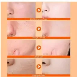 Exfoliating Kojic Acid Turmeric Spray